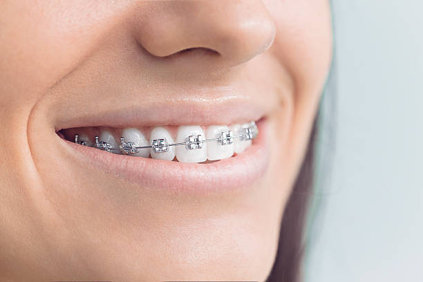Best Veneers and Lumineers  in Oakbrook Terrace, IL